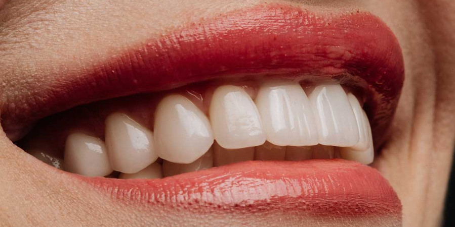 Est-ce que la cigarette electronique jaunit les dents ?